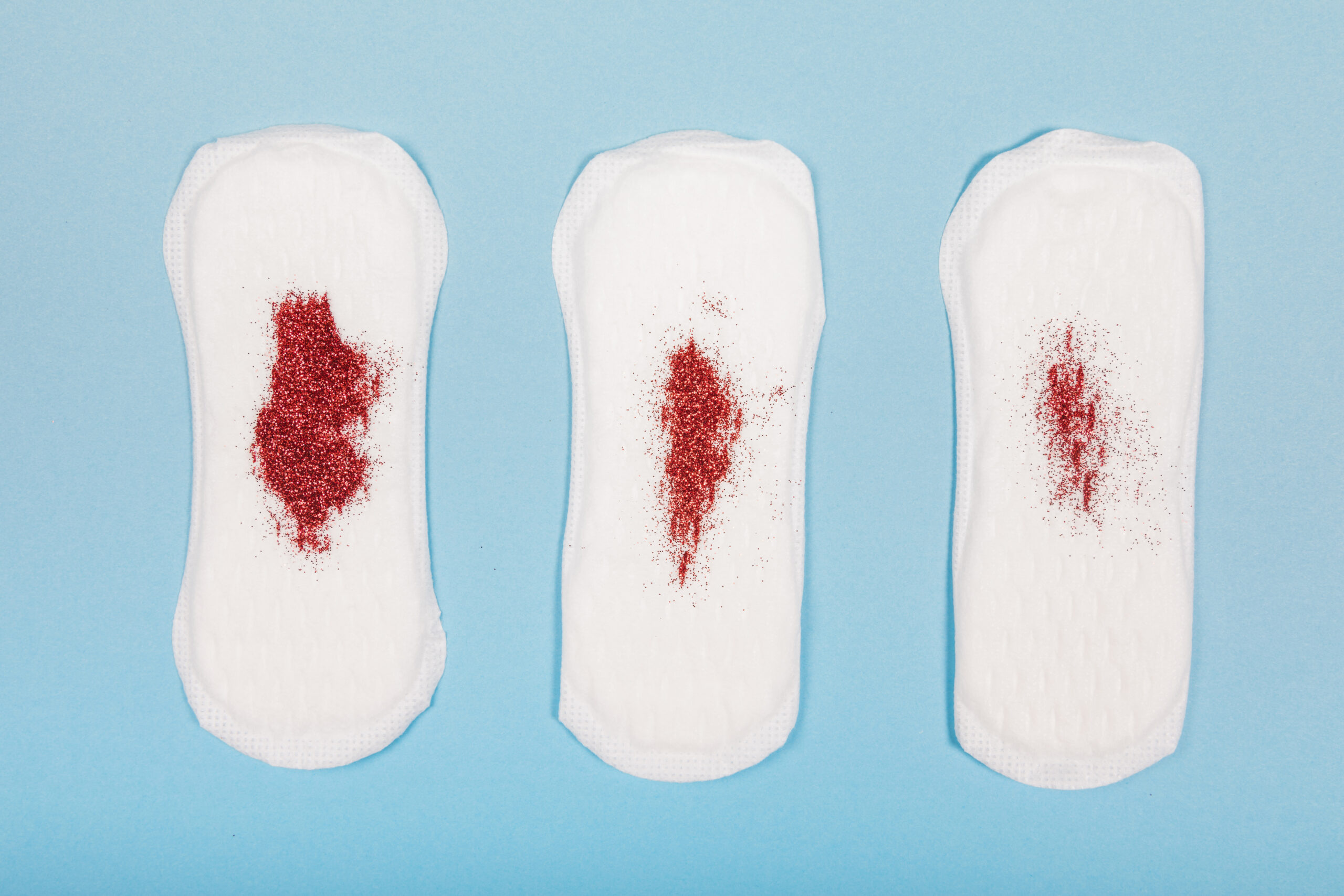 implantation bleeding